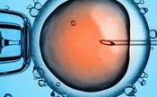 试管婴儿促排方案中常见的流程及相关数据介绍