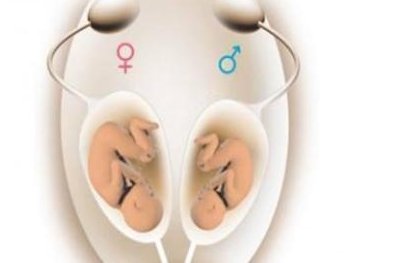 拮抗剂方案第二次促排需要间隔多久